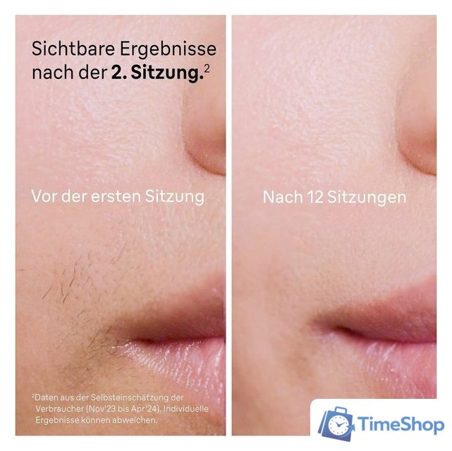 Фотоэпилятор Braun Silk-Expert Pro 5 PL5140 - Изображение №4 — Интернет-магазин Time-Shop