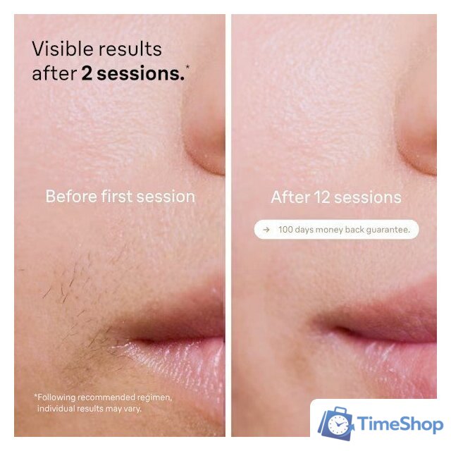 Фотоэпилятор Braun Silk-expert Pro 5 PL5242 - Изображение №4 — Интернет-магазин Time-Shop