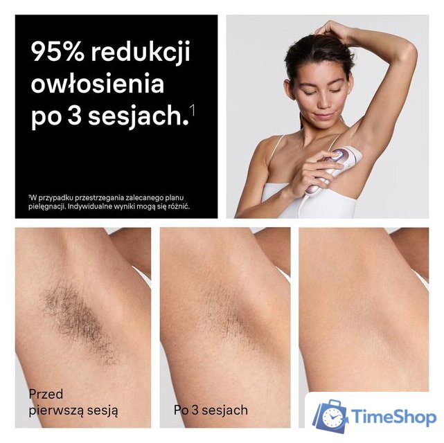 Фотоэпилятор Braun Skin i-expert Pro IPL PL7432 - Изображение №9 — Интернет-магазин Time-Shop