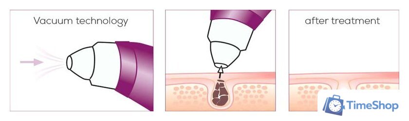 Прибор для вакуумной чистки Beurer FC 41 - Изображение №3 — Интернет-магазин Time-Shop
