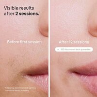 Фотоэпилятор Braun Silk-expert Pro 5 PL5242 - Превью изображения №4 — Интернет-магазин Time-Shop