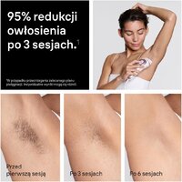 Фотоэпилятор Braun Skin i-expert Pro IPL PL7432 - Превью изображения №9 — Интернет-магазин Time-Shop