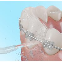 Ирригатор  Cecotec Bamba ToothCare 1100 Jet Liberty - Превью изображения №9 — Интернет-магазин Time-Shop