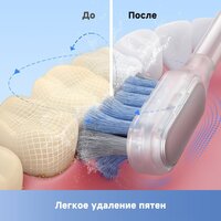 Электрическая зубная щетка Trouver 3D Clean Electric Toothbrush ATB15A (черный) - Превью изображения №9 — Интернет-магазин Time-Shop
